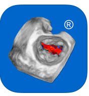 Galería de imágenes del libro CARDIO3® Atlas of 3D Echocardiography. Foto 1