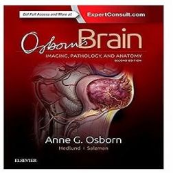 Galería de imágenes del libro Osborn's Brain. Imaging, Pathology, and Anatomy. Foto 1