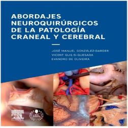 Galería de imágenes del libro Abordajes neuroquirúrgicos de la patología craneal y cerebral. Foto 1