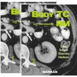 Galería de imágenes del libro Body TC con correlación RM 2 Vols.. Foto 1