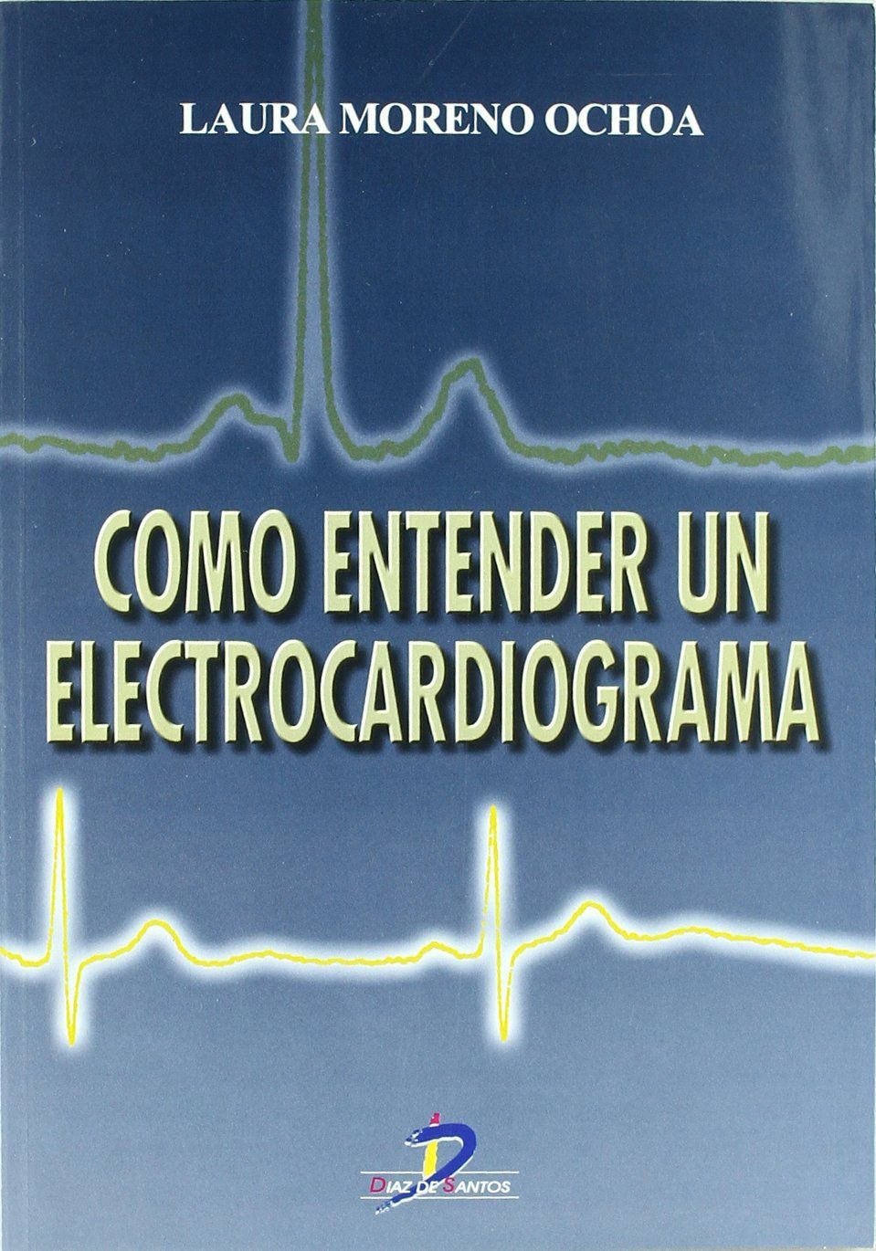 Cómo Entender un Electrocardiograma