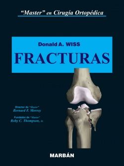 Fracturas - Wiss