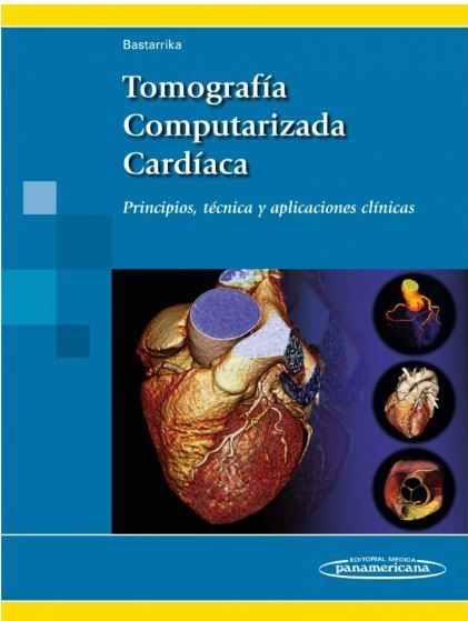 Tomografía Computarizada Cardíaca Principios, técnica y aplicaciones clínicas