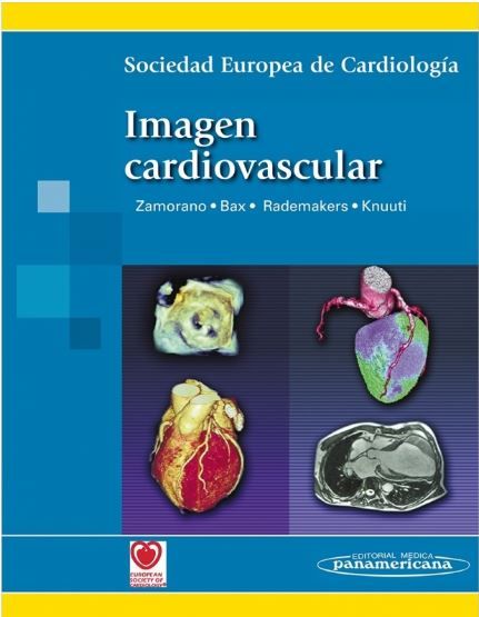SEC Imagen cardiovascular