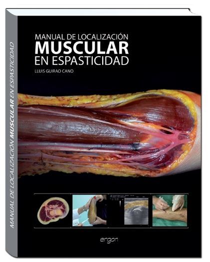 Manual de localización muscular en espasticidad