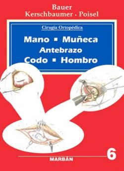 Cirugía Ortopédica - Vol 6 - Mano, Muñeca, Antebrazo, Codo, Hombro