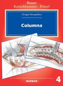 Cirugía Ortopédica - Vol 4 - Columna