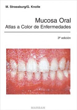 Mucosa Oral. Atlas a Color de Enfermedades