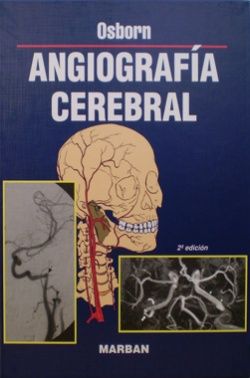 Angiografía Cerebral