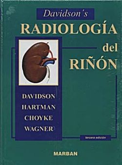 Galería de imágenes del libro Davidson´s Radiología del Riñón. Foto 1