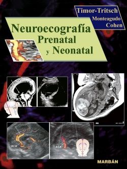 Galería de imágenes del libro Neuroecografía Prenatal y Neonatal. Foto 1