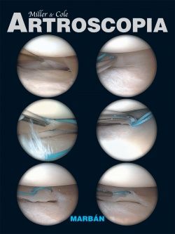 Galería de imágenes del libro Artroscopia-Miller. Foto 1