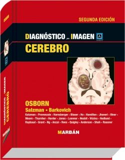 Galería de imágenes del libro Cerebro (OUTLET). Foto 1
