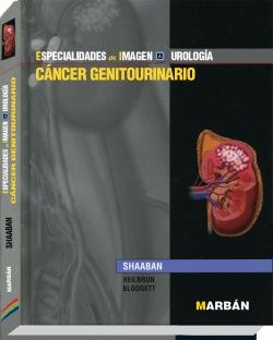 Galería de imágenes del libro Oncología Genitourinario. Foto 1