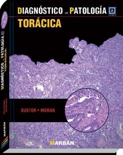 Galería de imágenes del libro Torácica. Foto 1