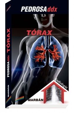 Galería de imágenes del libro Tórax - PEDROSA. Foto 1