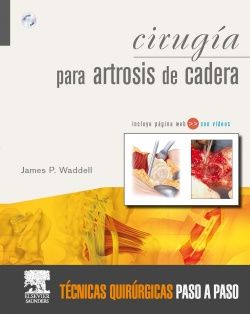 Galería de imágenes del libro Cirugía para Artrosis de Cadera (outlet). Foto 1