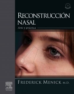 Galería de imágenes del libro Reconstrucción Nasal. Foto 1