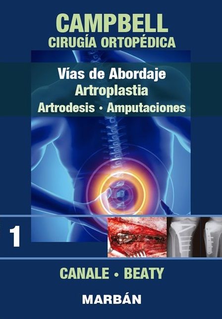 Cirugía Ortopédica. Tomo 1 Vías de abordaje, artrodesis, amputaciones