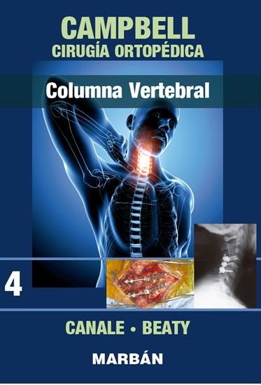 Cirugía Ortopédica. Tomo 4 Columna vertebral