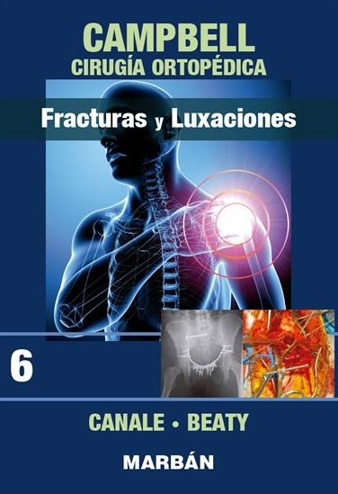 Cirugía Ortopédica. Tomo 6 Fracturas y luxaciones