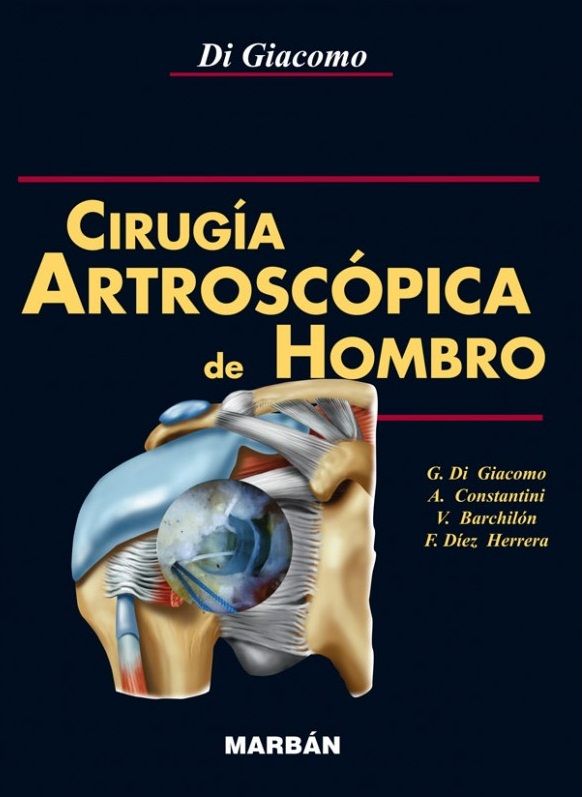 Cirugía artroscópica del hombro - flexilibro