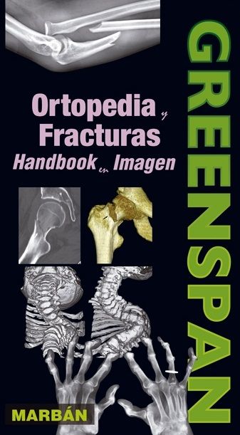 Ortopedia y Fracturas . Handbook en Imagen