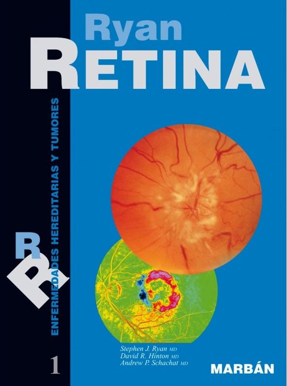Retina Vol. 1º Enfermedades Hereditarias y Tumores