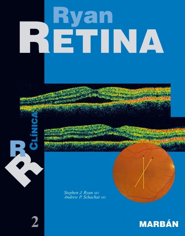 Retina Vol. 2º Clínica