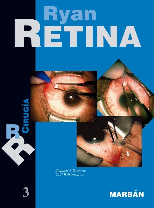 Retina Vol. 3º Cirugía