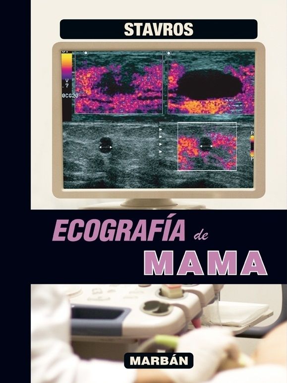 Ecografía de Mama