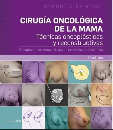 Cirugía oncológica de la mama 4ª Edición