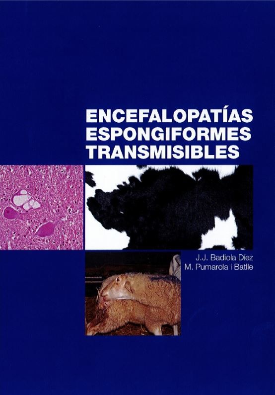 Encefalopatías Espongiformes Transmisibles