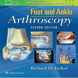 Galería de imágenes del libro Foot and Ankle Arthroscopy. Foto 1