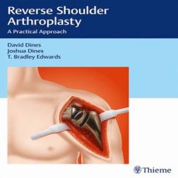 Galería de imágenes del libro Reverse Shoulder Arthroplasty. A Practical Approach. Foto 1