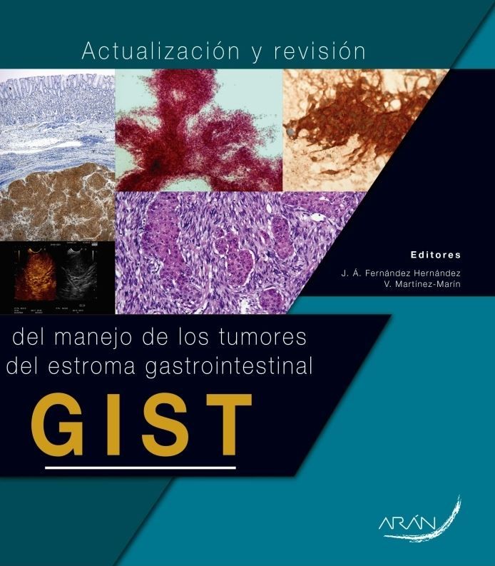 GIST Tumores del estroma gastrointestinal