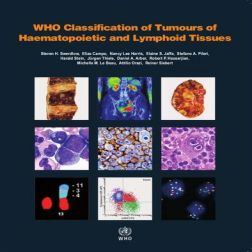 Galería de imágenes del libro WHO Classification of Tumours of Haematopoietic and Lymphoid Tissues. Foto 1