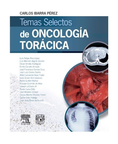 Temas selectos de oncología torácica