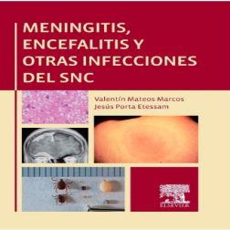 Galería de imágenes del libro Meningitis, encefalitis y otras infecciones del SNC. Foto 1
