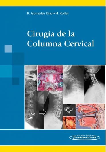 Cirugía de la Columna Cervical