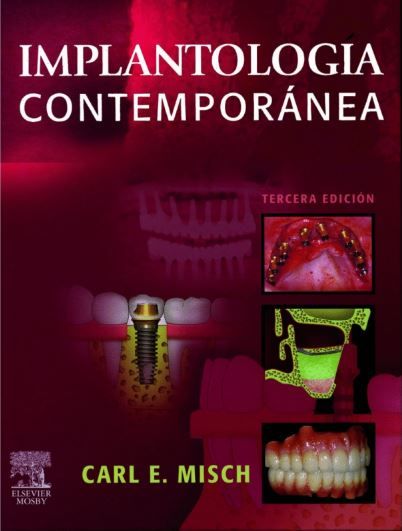 Implantología Contemporánea
