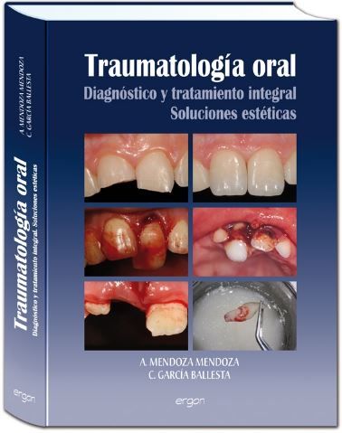 Traumatología oral Diagnóstico y tratamiento integral soluciones estéticas