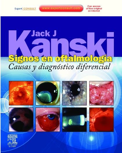 SIGNOS DE OFTALMOLOGIA. CAUSAS Y DIAGNOSTICO DIFERENCIAL + EXPERT