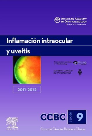 Inflamación intraocular y uveítis 2011-2012