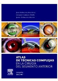 Galería de imágenes del libro Atlas de técnicas complejas en la cirugía del segmento anterior. Foto 1