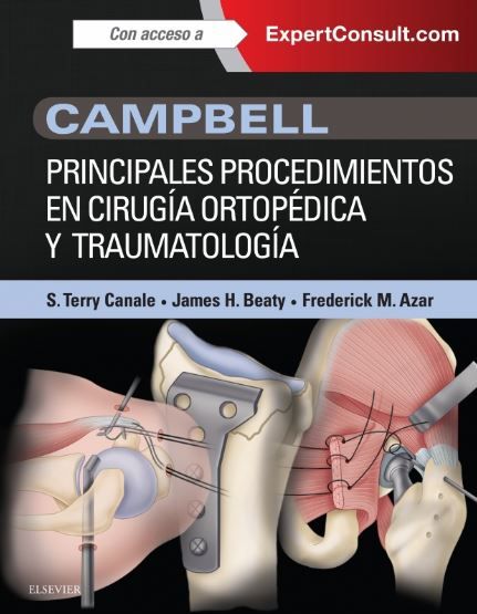 Campbell Principales procedimientos en C.O.T