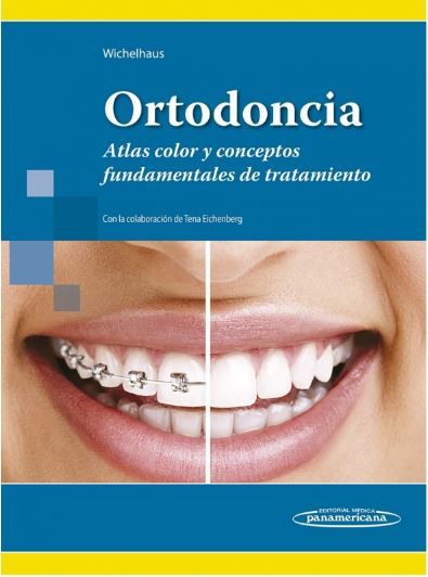 Ortodoncia . Atlas Color y Conceptos fundamentales de Tratamiento