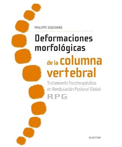 Deformaciones Morfológicas de la Columna Vertebral