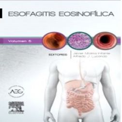Galería de imágenes del libro Esofagitis Eosinofílica. Foto 1